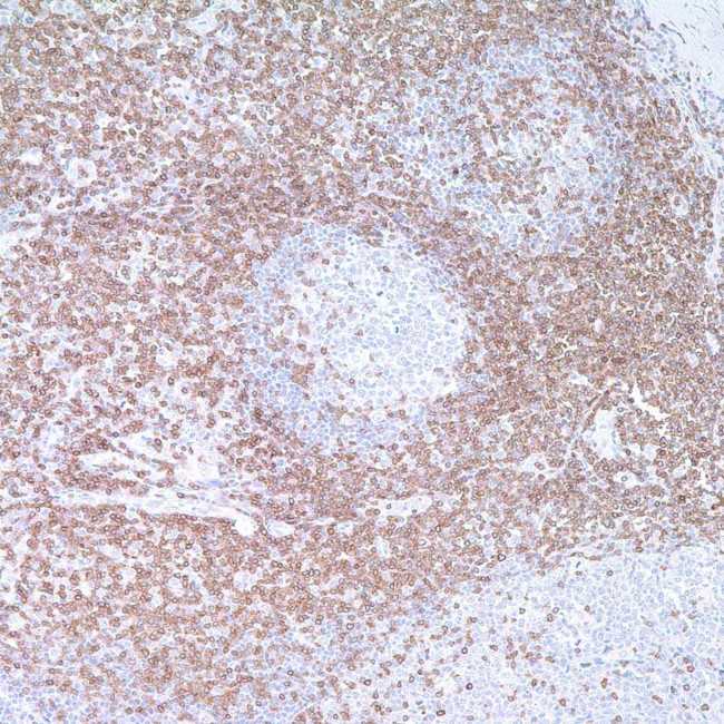 CD3e Antibody in Immunohistochemistry (IHC)