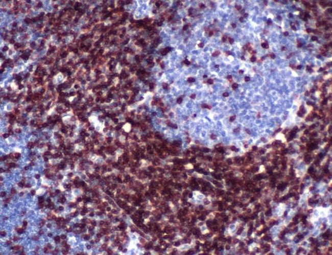 CD3e Antibody in Immunohistochemistry (IHC)