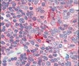 CD4 Antibody in Immunohistochemistry (IHC)
