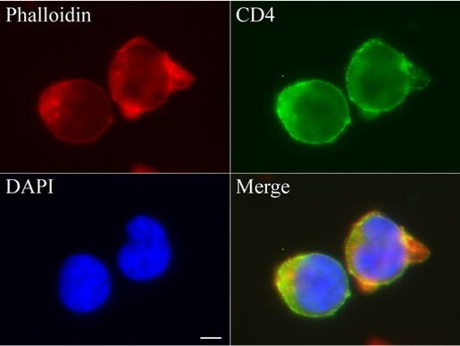 CD4 Antibody in Immunocytochemistry (ICC/IF)