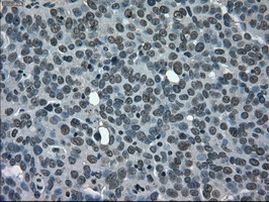 CD4 Antibody in Immunohistochemistry (Paraffin) (IHC (P))