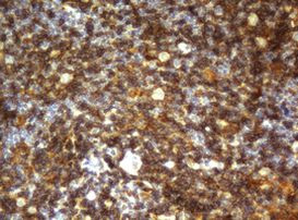 CD4 Antibody in Immunohistochemistry (Paraffin) (IHC (P))