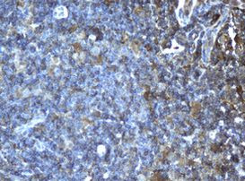 CD4 Antibody in Immunohistochemistry (Paraffin) (IHC (P))