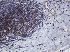 CD4 Antibody in Immunohistochemistry (Paraffin) (IHC (P))