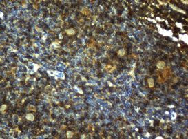 CD4 Antibody in Immunohistochemistry (Paraffin) (IHC (P))
