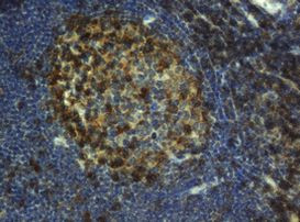 CD4 Antibody in Immunohistochemistry (Paraffin) (IHC (P))