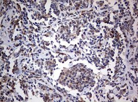 CD4 Antibody in Immunohistochemistry (Paraffin) (IHC (P))