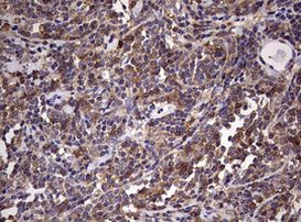 CD4 Antibody in Immunohistochemistry (Paraffin) (IHC (P))