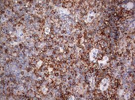 CD4 Antibody in Immunohistochemistry (Paraffin) (IHC (P))