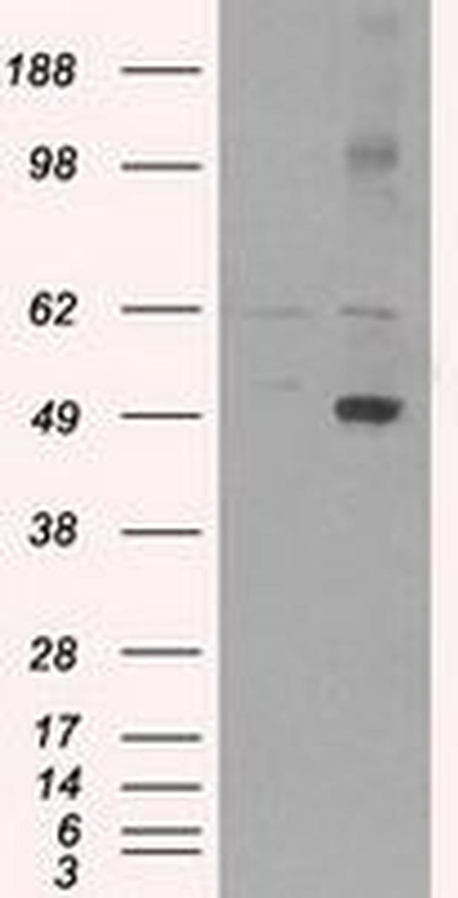 CD4 Antibody in Western Blot (WB)