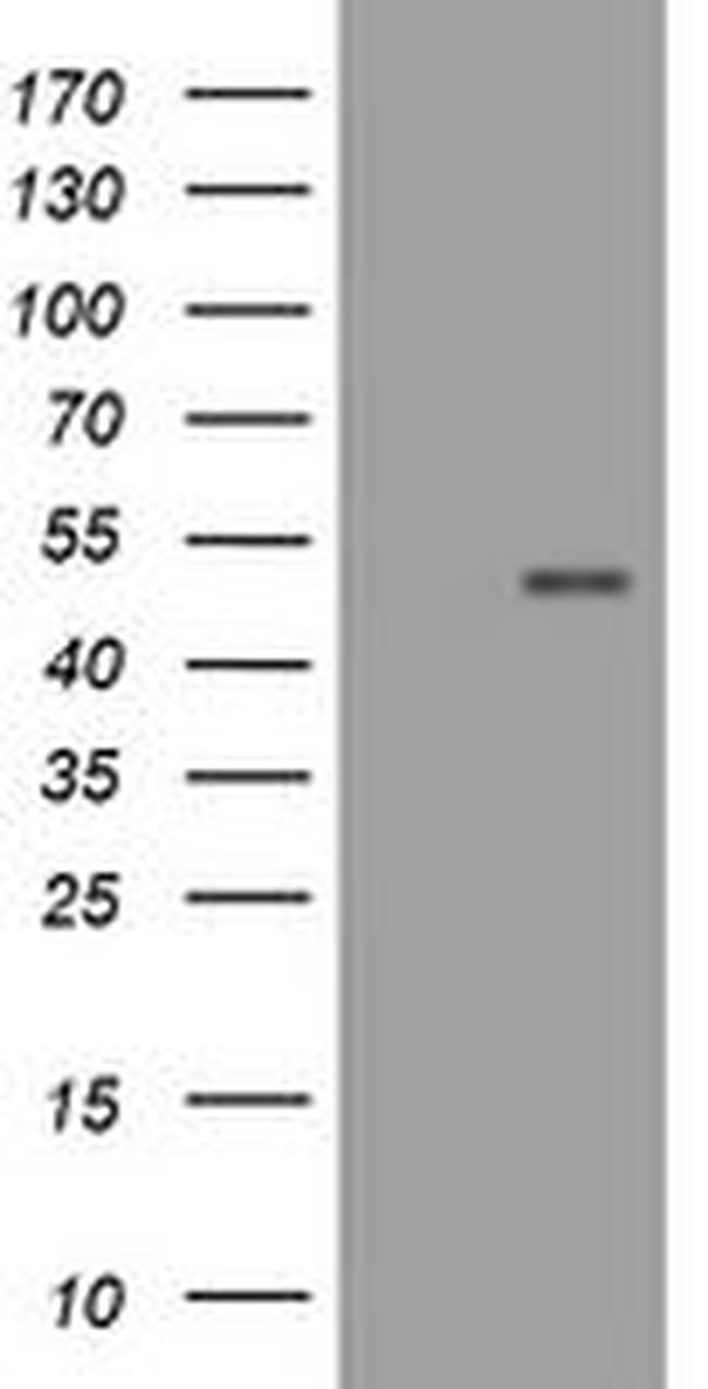 CD4 Antibody in Western Blot (WB)