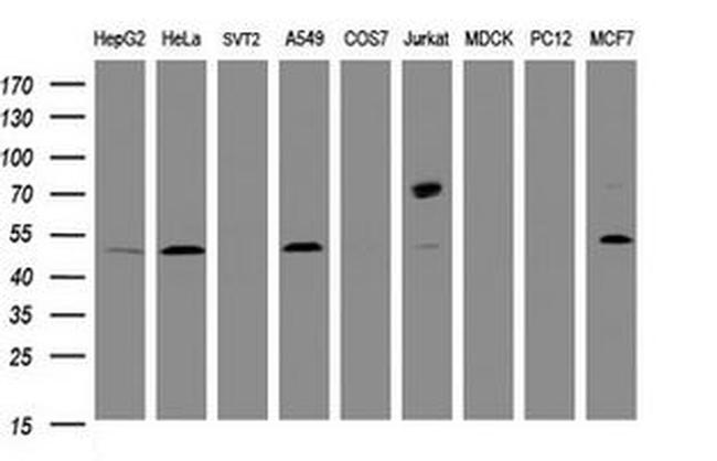 CD4 Antibody in Western Blot (WB)