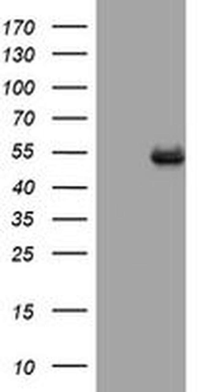CD4 Antibody in Western Blot (WB)