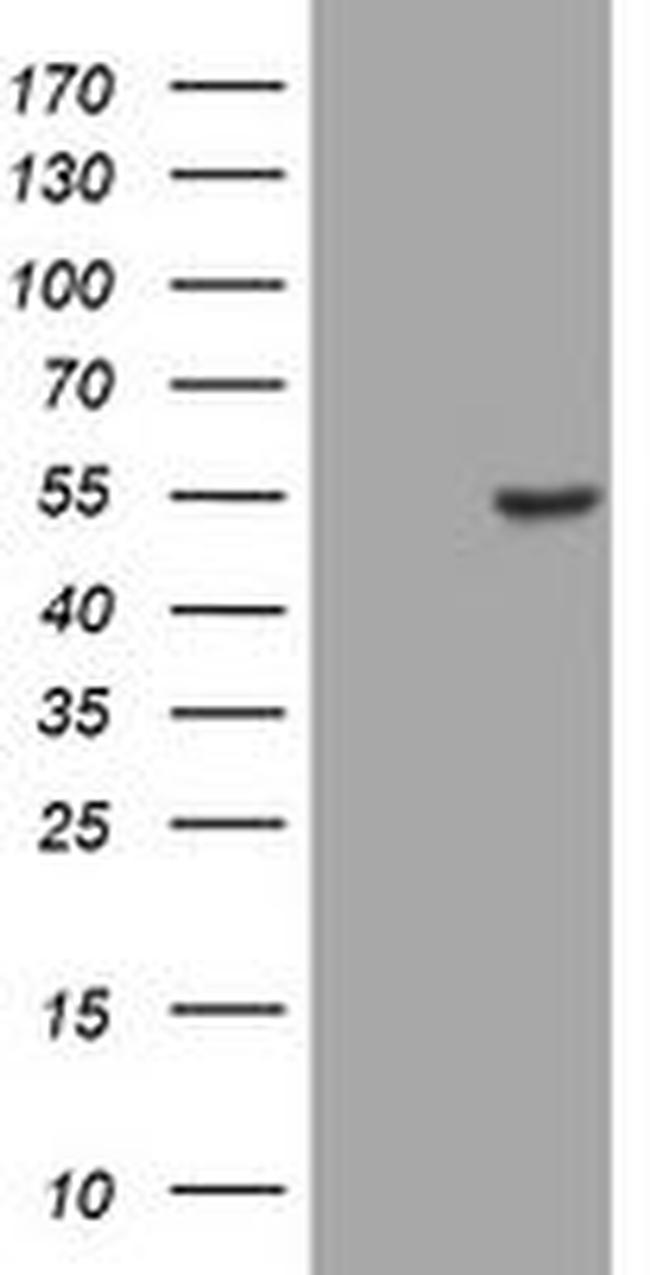 CD4 Antibody in Western Blot (WB)