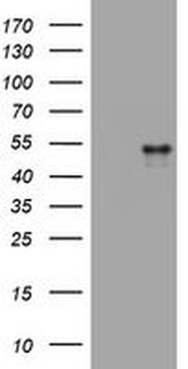 CD4 Antibody in Western Blot (WB)