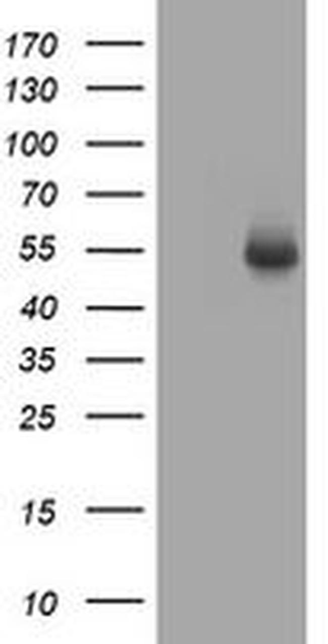 CD4 Antibody in Western Blot (WB)