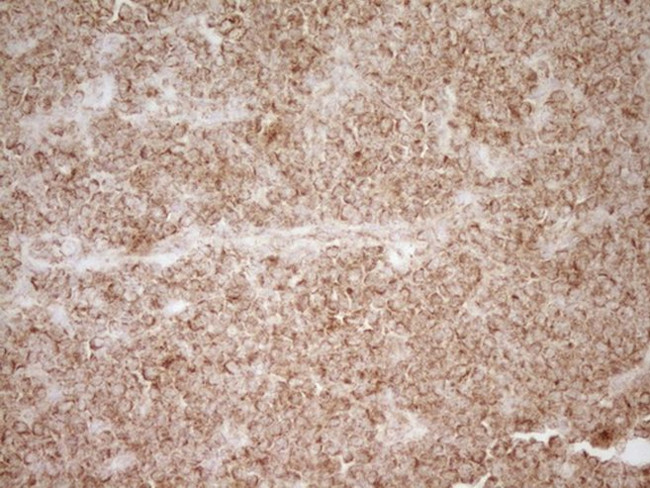 CD40 Antibody in Immunohistochemistry (Paraffin) (IHC (P))