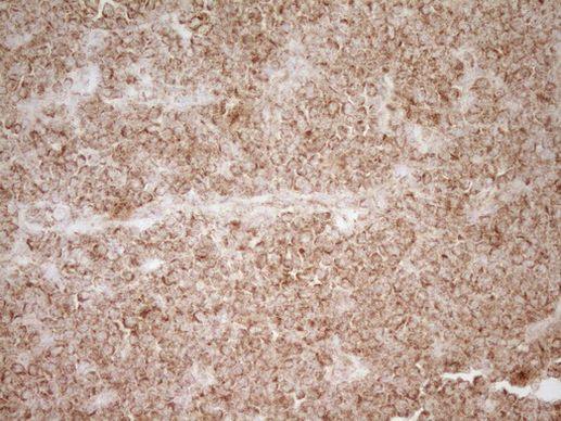 CD40 Antibody in Immunohistochemistry (Paraffin) (IHC (P))