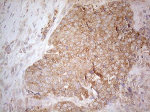CD40 Antibody in Immunohistochemistry (Paraffin) (IHC (P))