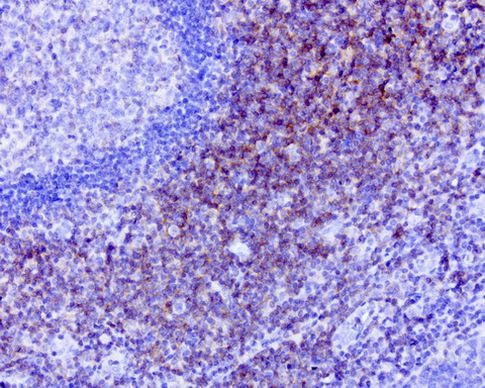CD40 Antibody in Immunohistochemistry (Paraffin) (IHC (P))