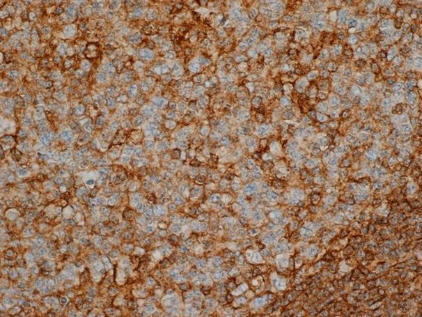 CD44 Antibody in Immunohistochemistry (Paraffin) (IHC (P))