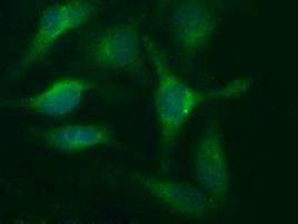 CD44 Antibody in Immunocytochemistry (ICC/IF)