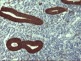 CD44 Antibody in Immunohistochemistry (Paraffin) (IHC (P))