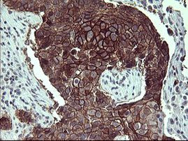 CD44 Antibody in Immunohistochemistry (Paraffin) (IHC (P))