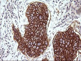 CD44 Antibody in Immunohistochemistry (Paraffin) (IHC (P))