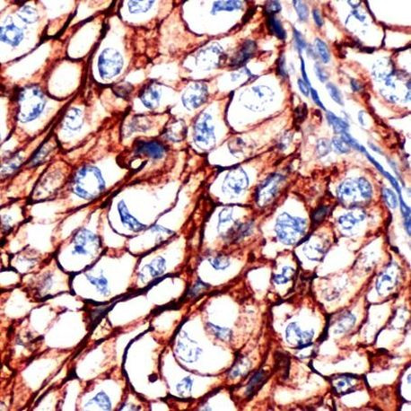 CD44 Antibody in Immunohistochemistry (IHC)