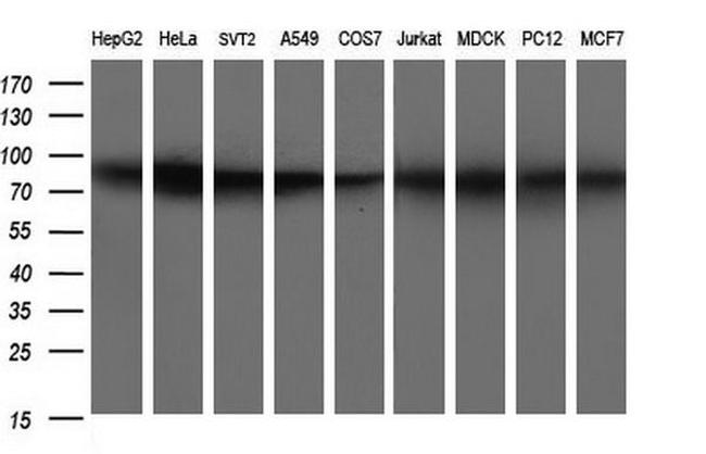 CD44 Antibody in Western Blot (WB)