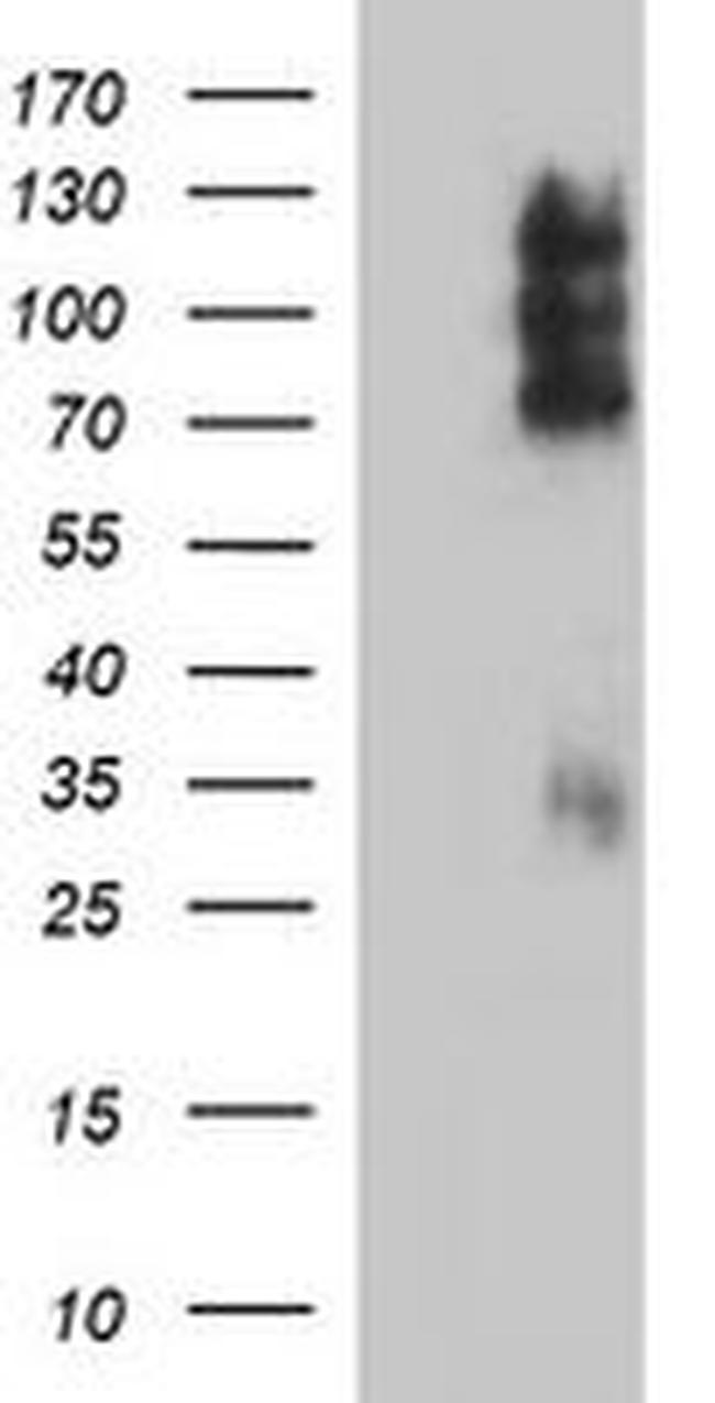 CD44 Antibody in Western Blot (WB)