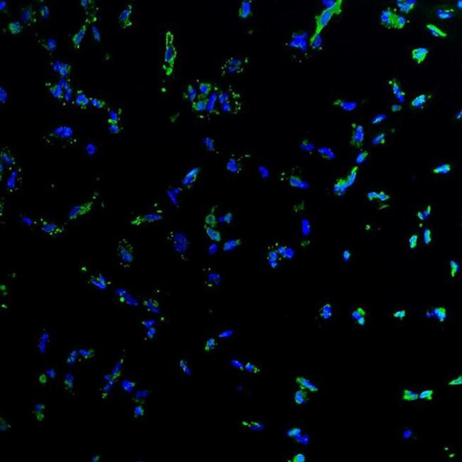 CD105 Antibody in Immunocytochemistry (ICC/IF)