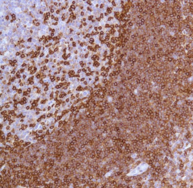 CD45 Antibody in Immunohistochemistry (IHC)