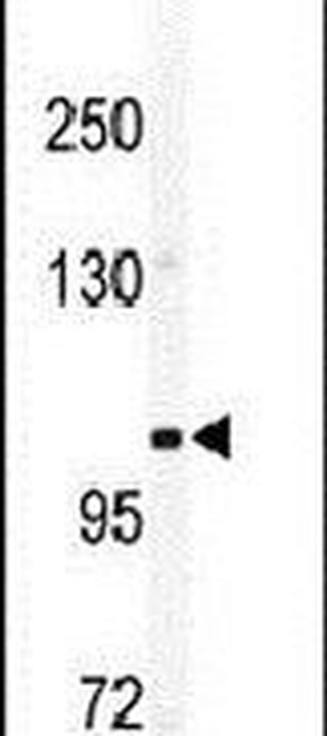 ITGA5 Antibody in Western Blot (WB)