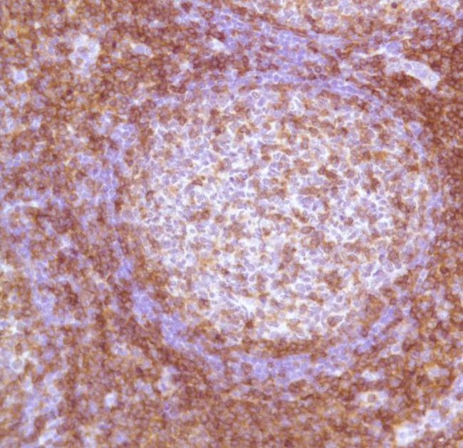 CD4 Antibody in Immunohistochemistry (Paraffin) (IHC (P))