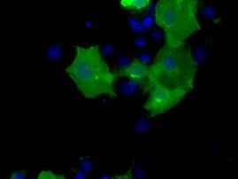 CD5 Antibody in Immunocytochemistry (ICC/IF)