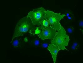 CD5 Antibody in Immunocytochemistry (ICC/IF)