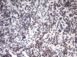 CD5 Antibody in Immunohistochemistry (Paraffin) (IHC (P))