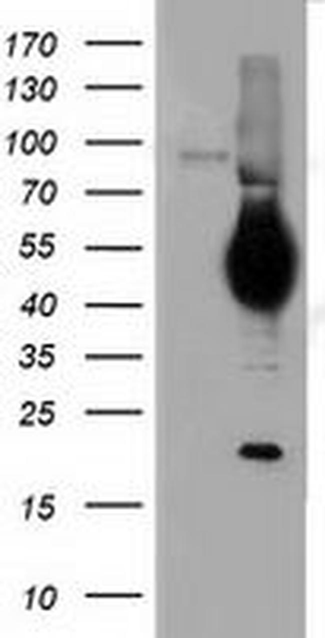CD5 Antibody in Western Blot (WB)