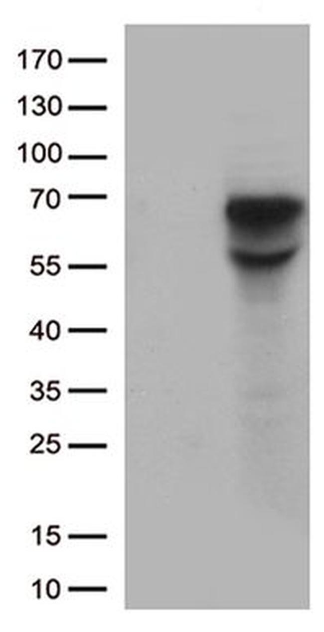CD5 Antibody in Western Blot (WB)