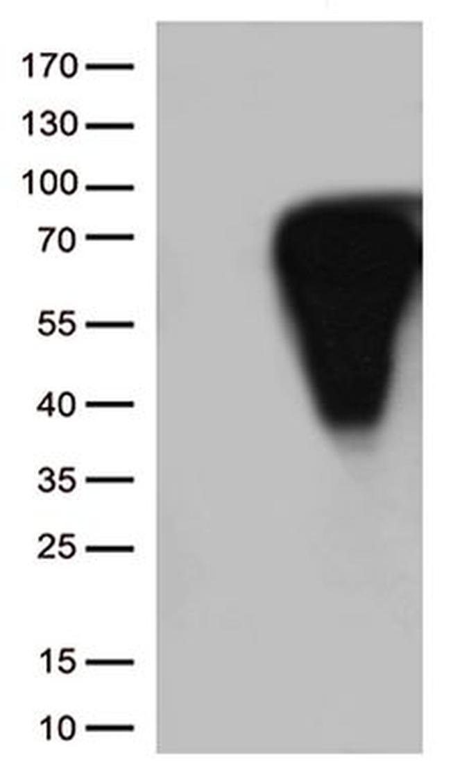CD5 Antibody in Western Blot (WB)
