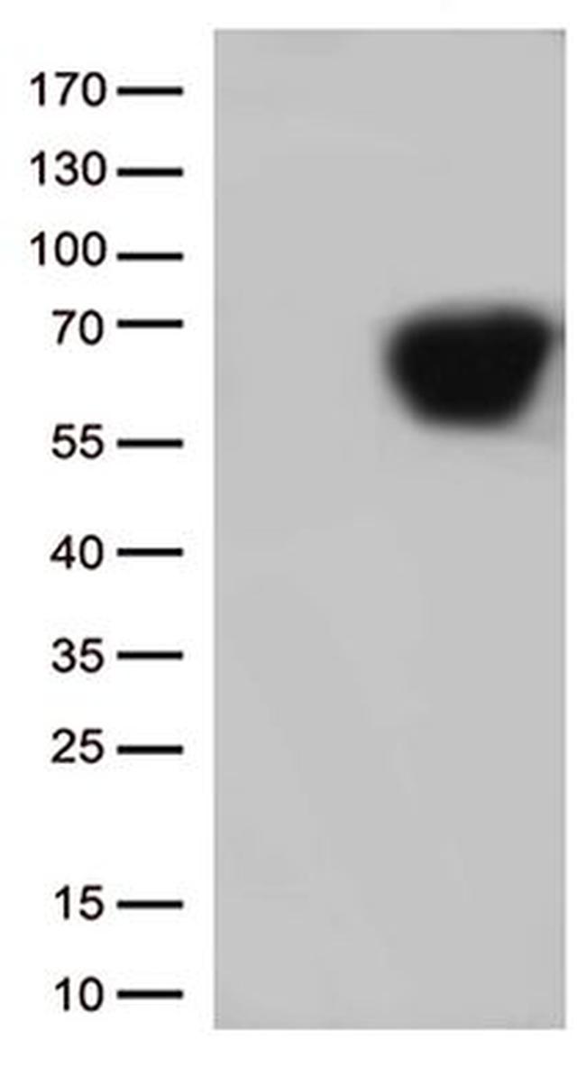 CD5 Antibody in Western Blot (WB)