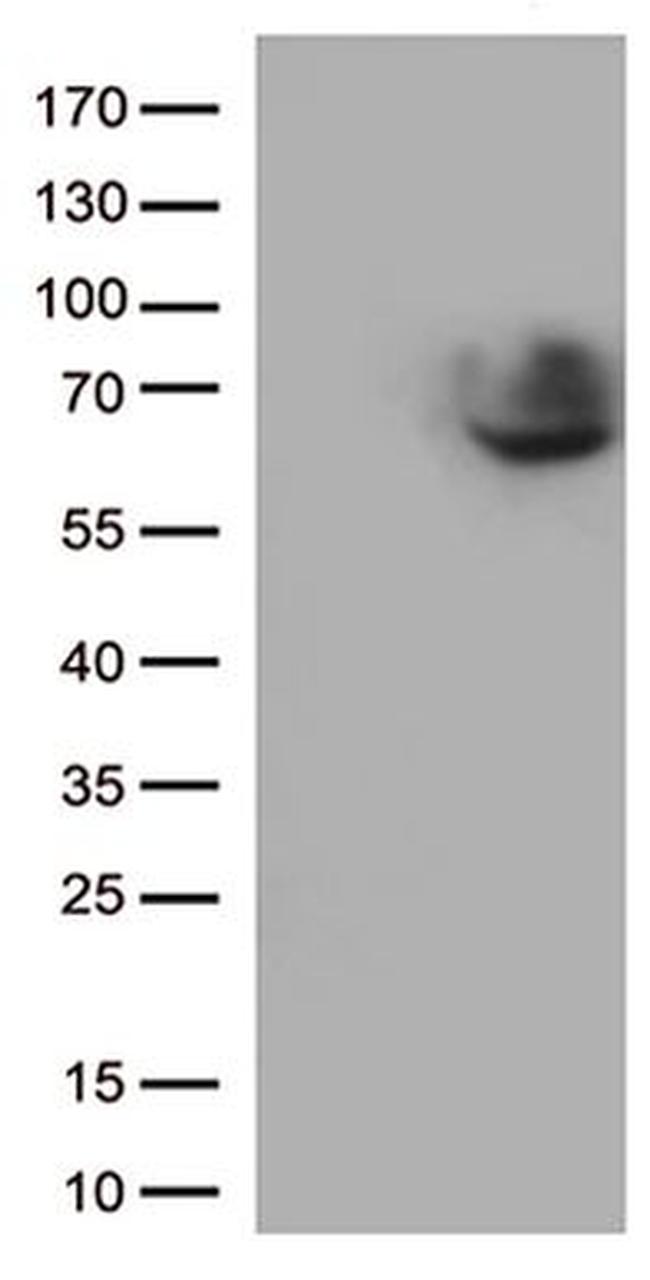 CD5 Antibody in Western Blot (WB)