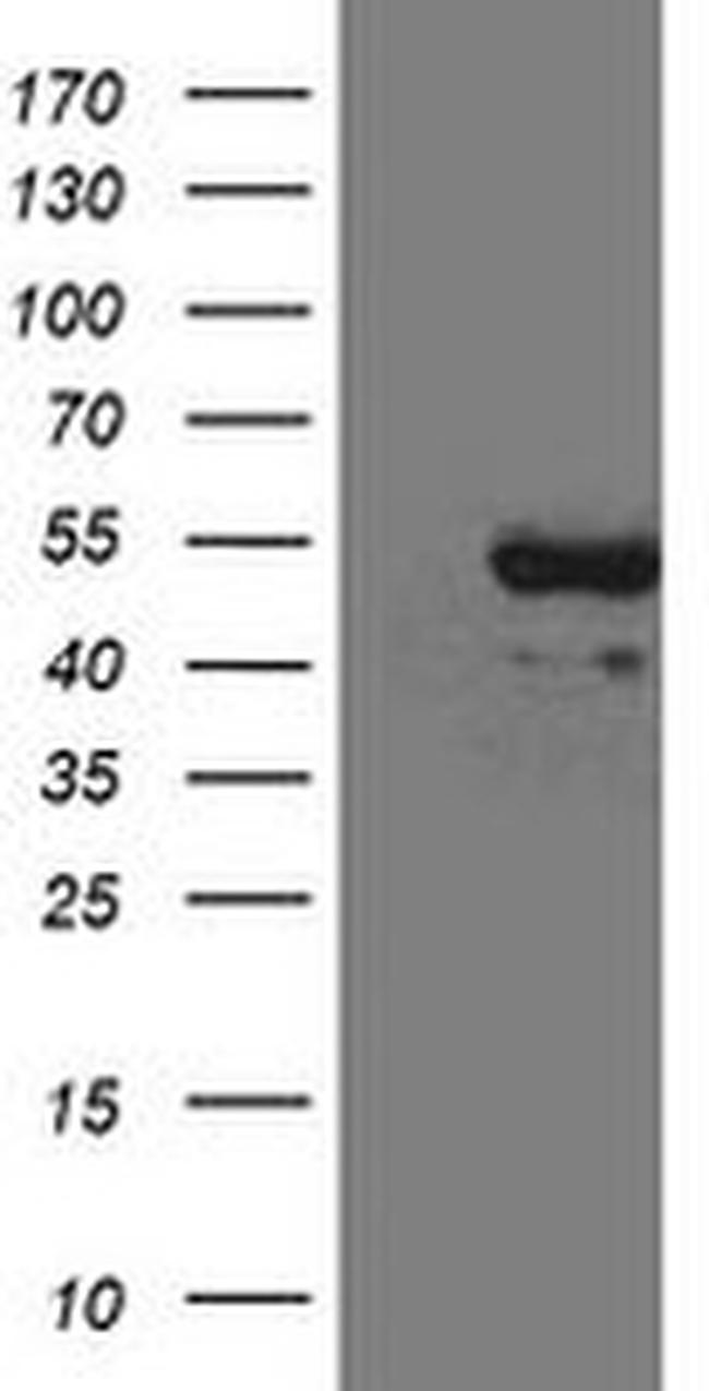CD5 Antibody in Western Blot (WB)