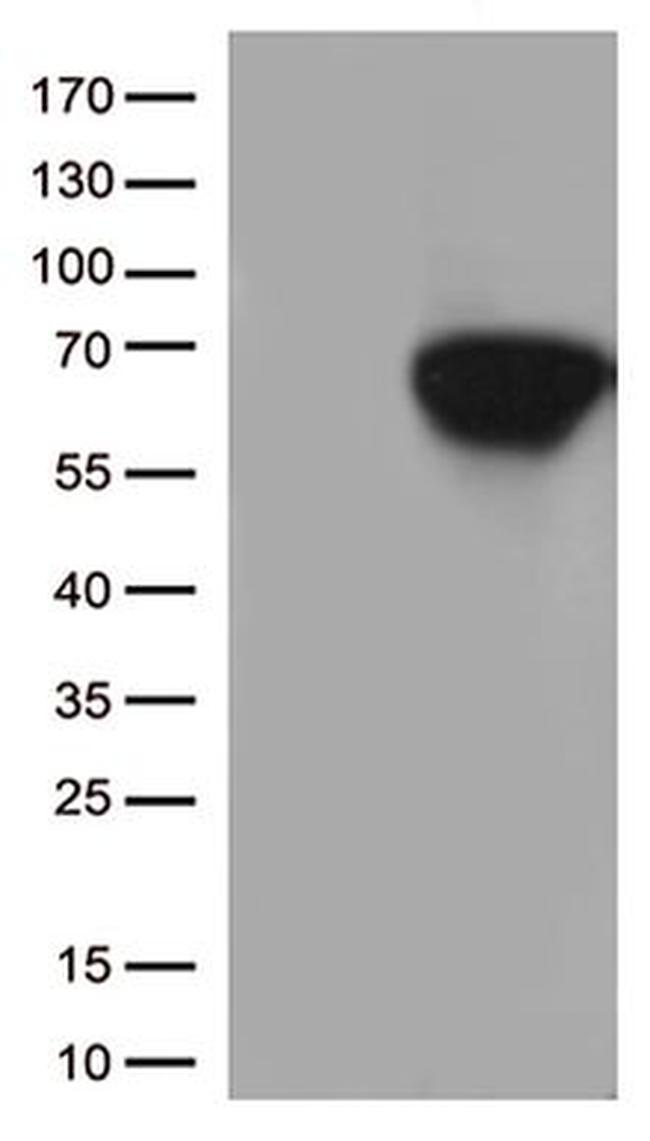 CD5 Antibody in Western Blot (WB)