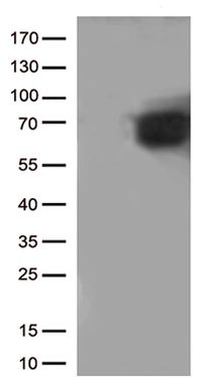 CD5 Antibody in Western Blot (WB)