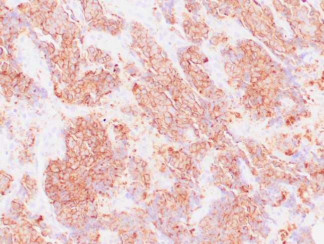 CD56 Antibody in Immunohistochemistry (Paraffin) (IHC (P))