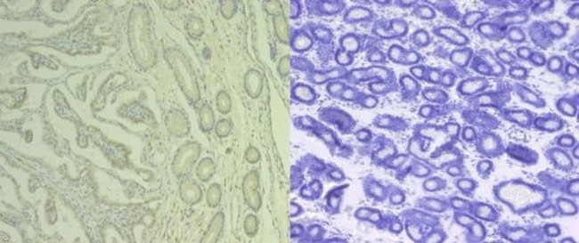 CD61 Antibody in Immunohistochemistry (Paraffin) (IHC (P))