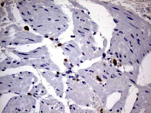 CD63 Antibody in Immunohistochemistry (Paraffin) (IHC (P))
